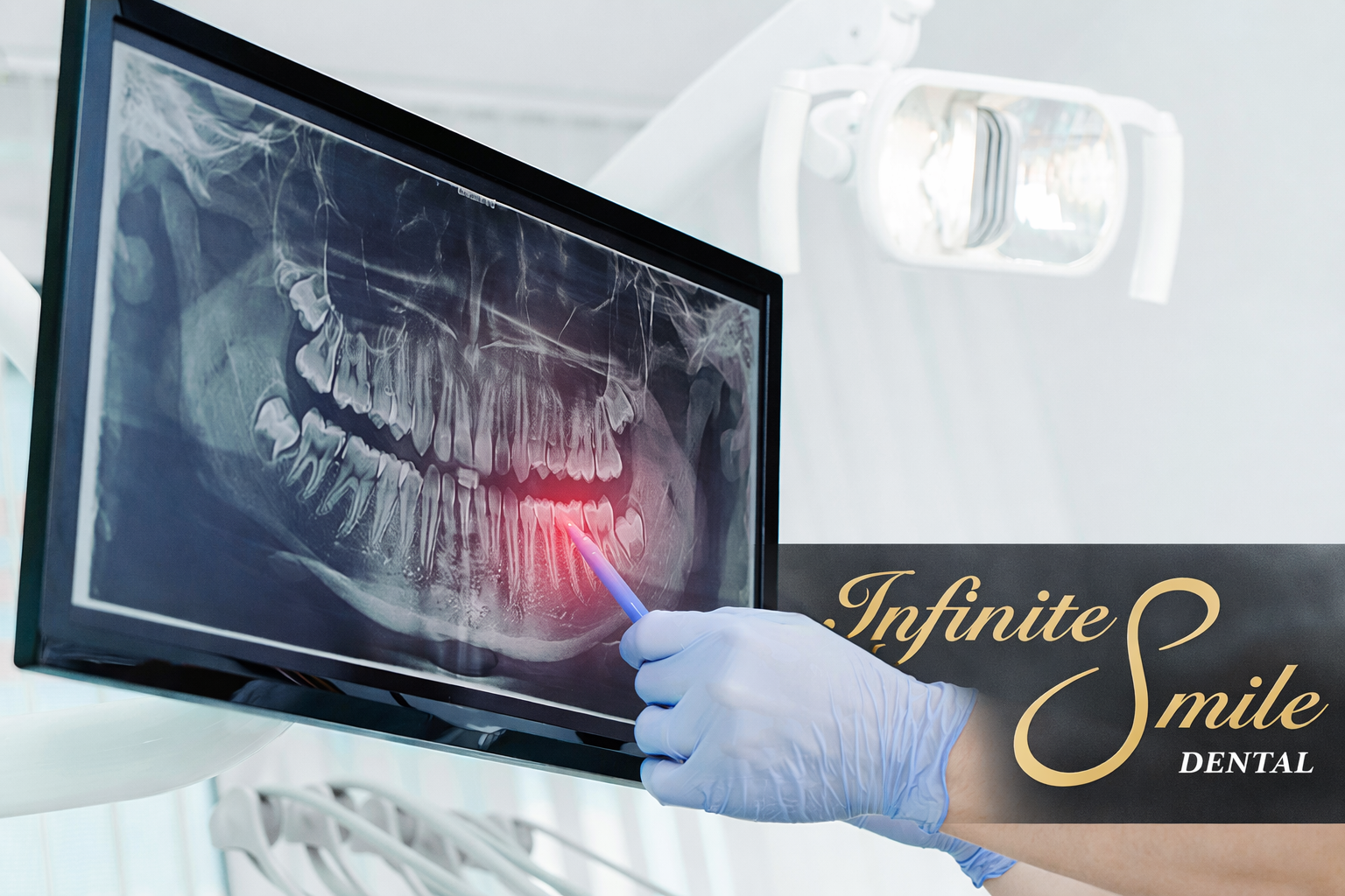 The Benefits and Importance of Digital X-Rays in Pleasanton, CA